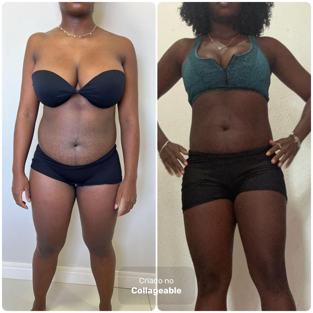Antes e depois - aluna 1