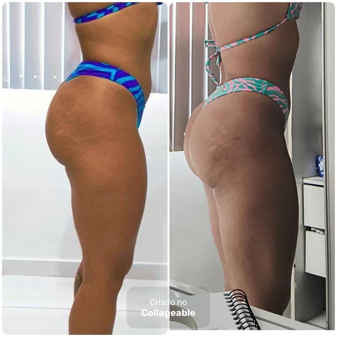 Antes e depois - aluna 6